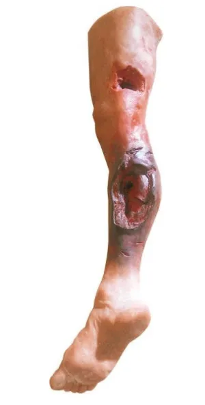 Emergency Leg Trainers